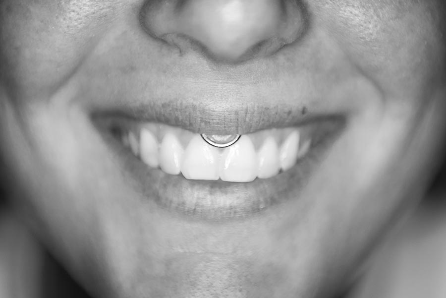 smiley piercing - Subliminal Tattoo Family